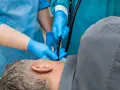 Lekarze w niebieskich rękawiczkach wykonują badanie endoskopowe pacjentowi.