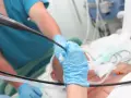 Lekarz w niebieskich rękawiczkach wykonuje bronchoskopię pacjentowi podłączonemu do respiratora.