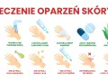 Ilustracja pokazuje leczenie oparzeń skóry: chłodna woda, maść z antybiotykiem, zimny kompres, tabletki przeciwbólowe, sok z aloesu. Unikaj masła, jajek, pasty do zębów, lodu.