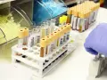 Probówki z próbkami krwi w laboratorium, ręka w rękawiczce pobiera jedną z nich.