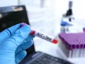 Ręka w niebieskiej rękawiczce trzyma probówkę z krwią oznaczoną "ALT - Test". W tle mikroskop i stojak z probówkami.