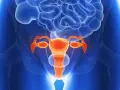 Anatomical illustration of the female reproductive system in orange against a blue background.