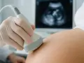 Dłoń w rękawiczce trzyma sondę USG na brzuchu kobiety, na ekranie widoczny obraz płodu.