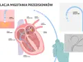 Ilustracja przedstawia schemat ablacji serca z cewnikami diagnostycznymi i ablacyjnymi w sercu.