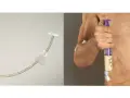 Gastrostomia endoskopowa (PEG) - przyrząd i zastosowanie.
