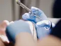 Czy na pogotowiu dentystycznym wyrywają zęby w nagłych przypadkach?