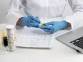 Laborant w rękawiczkach analizuje próbkę moczu, obok wyniki badań i laptop.