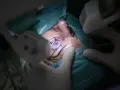 Chirurgiczne oko podczas zabiegu witrektomii, widoczne narzędzia i rękawiczki.
