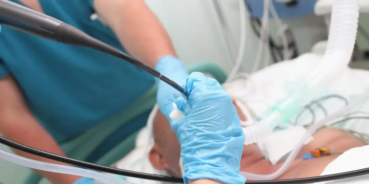 Lekarz w niebieskich rękawiczkach wykonuje bronchoskopię pacjentowi podłączonemu do respiratora.