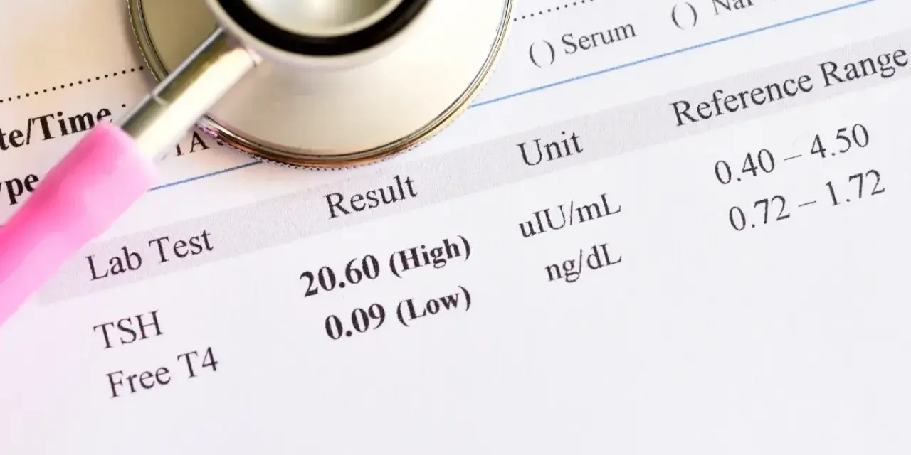 Stetoskop na wynikach badań laboratoryjnych TSH i Free T4, z zaznaczonymi wynikami wysokim i niskim.