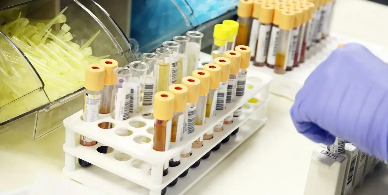 Probówki z próbkami krwi w laboratorium, ręka w rękawiczce pobiera jedną z nich.