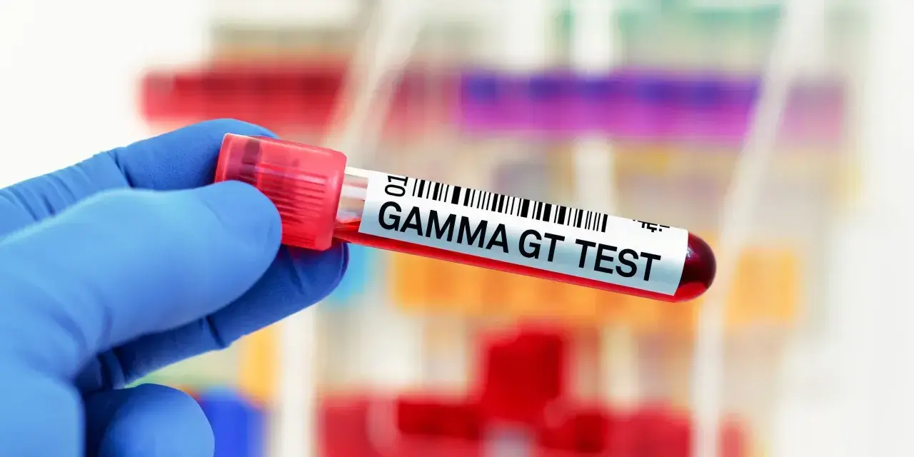 Ręka w niebieskiej rękawiczce trzyma probówkę z napisem "GAMMA GT TEST".