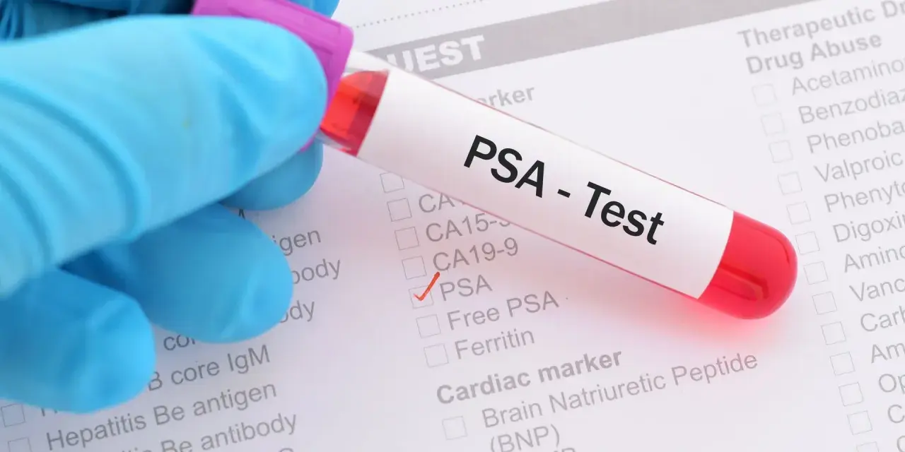 Probówka z krwią do badania PSA na tle formularza medycznego z zaznaczonym testem PSA.