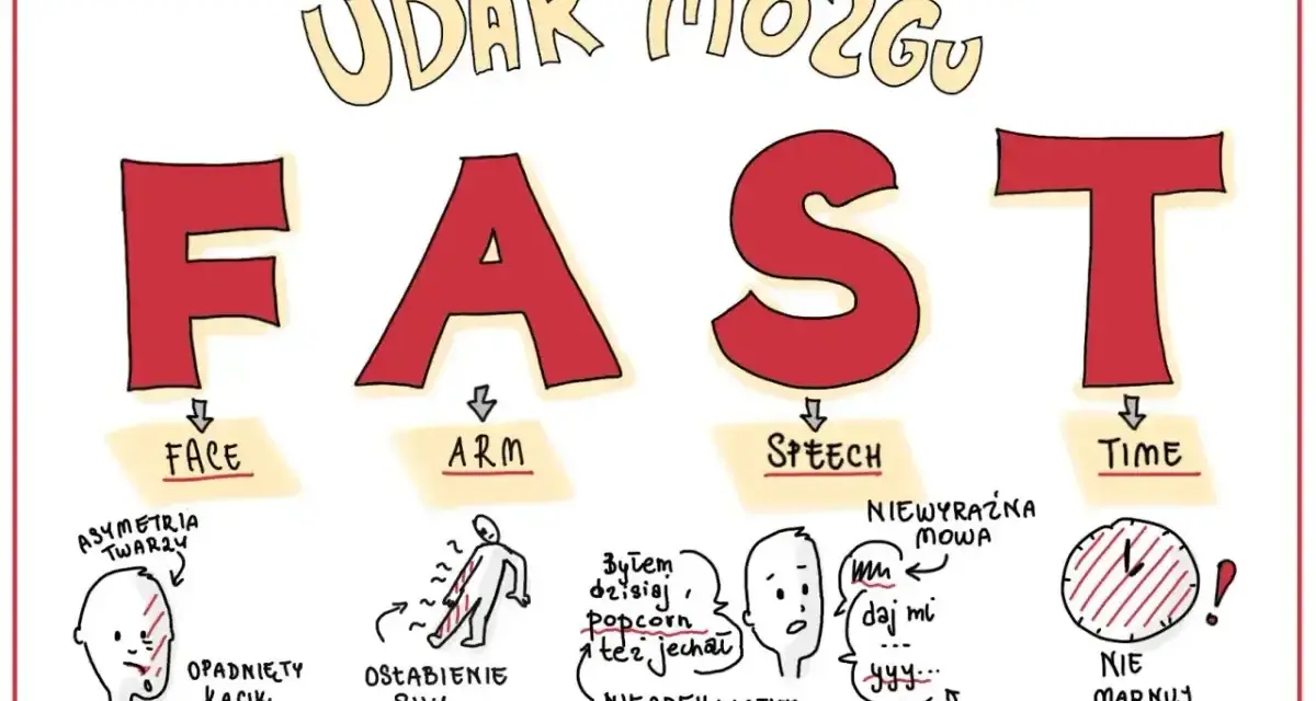Ilustracja przedstawia akronim FAST (Face, Arm, Speech, Time) opisujący objawy udaru mózgu.