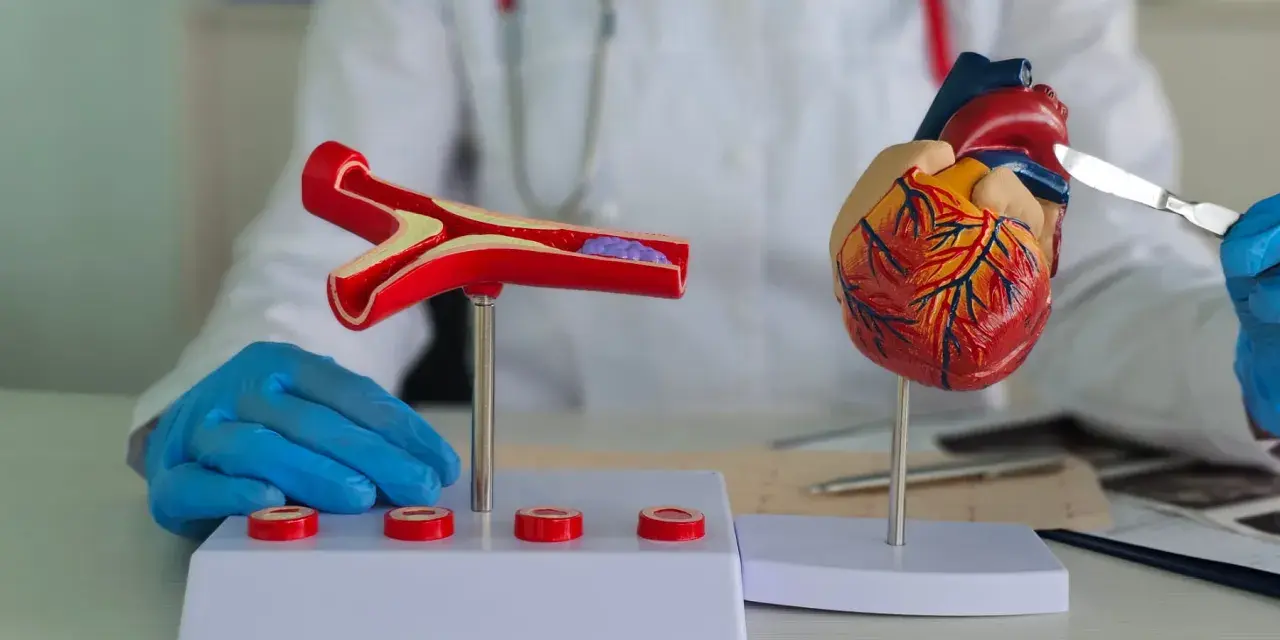 Model serca i przekrój naczynia krwionośnego z zakrzepem, prezentowane przez lekarza w białym fartuchu.