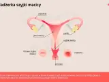 Ilustracja przedstawia budowę narządów rodnych kobiety z zaznaczoną nadżerką szyjki macicy.