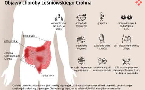 Objawy choroby Leśniowskiego-Crohna: krew w stolcu, zmęczenie, gorączka, problemy z oczami, biegunka, bóle brzucha, zapalenie skóry i stawów.