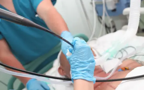 Lekarz w niebieskich rękawiczkach wykonuje bronchoskopię pacjentowi podłączonemu do respiratora.