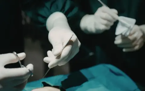 Dłonie chirurga w rękawiczkach trzymające narzędzia chirurgiczne i gazę.