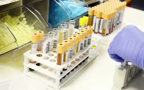 Probówki z próbkami krwi w laboratorium, ręka w rękawiczce pobiera jedną z nich.