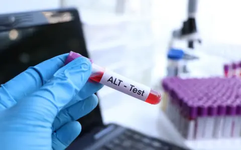 Ręka w niebieskiej rękawiczce trzyma probówkę z krwią oznaczoną "ALT - Test". W tle mikroskop i stojak z probówkami.