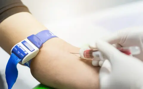 Pobieranie krwi do badań, w tym aptt. Opaska uciskowa na ramieniu, igła i probówka z krwią.