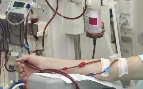 Ramię pacjenta podłączone do aparatury dializacyjnej z widocznymi przewodami i filtrem.