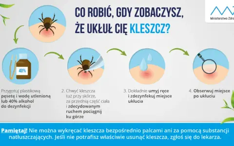 Instrukcja, jak wyciągnąć kleszcza: przygotuj pęsetę i środek dezynfekujący, chwyć kleszcza blisko skóry i pociągnij, umyj ręce i miejsce ukłucia, obserwuj.
