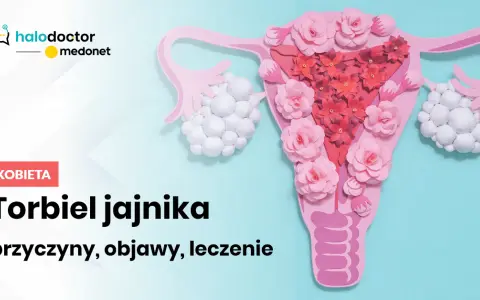 Jakie leki na torbiel jajnika? Skuteczne opcje leczenia i objawy