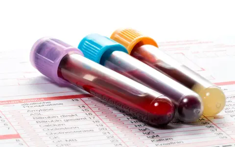 Trzy probówki z krwią na tle formularza laboratoryjnego z listą badań, w tym CRP.