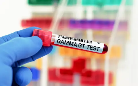 Ręka w niebieskiej rękawiczce trzyma probówkę z napisem "GAMMA GT TEST".