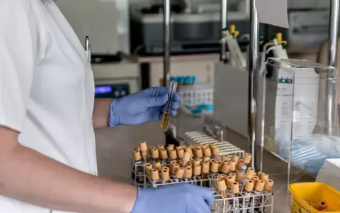 Laborant w niebieskich rękawiczkach trzyma probówkę z żółtym płynem na tle stojaków z próbówkami.