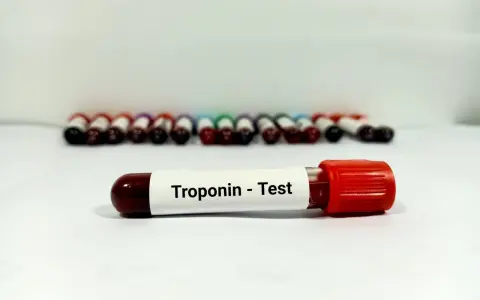 Probówka z oznaczeniem "Troponin - Test" na tle rzędu innych próbek krwi.