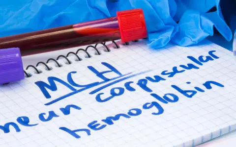 Probówka z krwią, notatnik z napisem "MCH mean corpuscular hemoglobin" i rękawiczki medyczne.