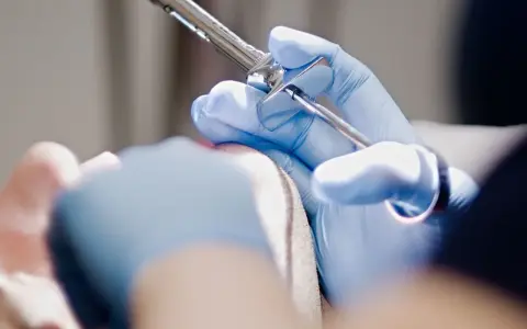 Czy na pogotowiu dentystycznym wyrywają zęby w nagłych przypadkach?