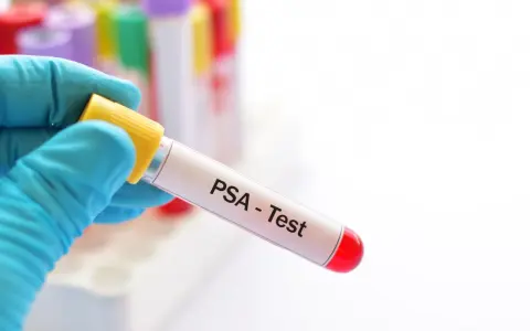 Ręka w niebieskiej rękawiczce trzyma probówkę z napisem "PSA - Test".