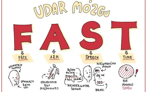 Ilustracja przedstawia akronim FAST (Face, Arm, Speech, Time) opisujący objawy udaru mózgu.