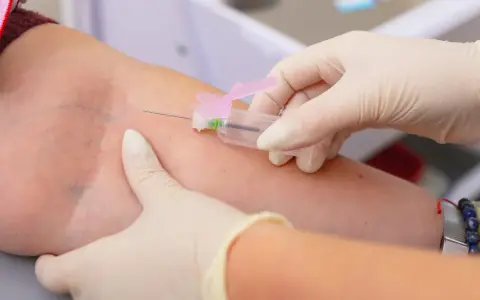 Pobieranie krwi do badań. Wyniki mogą wykazać, że limfocyty wysokie, co wymaga dalszej diagnostyki.