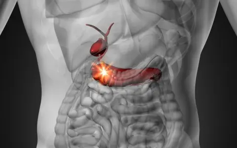 Anatomical illustration of a human torso showing a red gallbladder and pancreas with a bright light emanating from the pancreas.