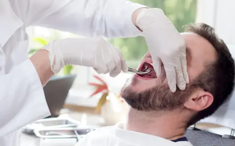 Dentysta w rękawiczkach używa kleszczy do usuwania zęba pacjentowi.