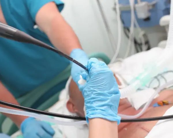 Lekarz w niebieskich rękawiczkach wykonuje bronchoskopię pacjentowi podłączonemu do respiratora.