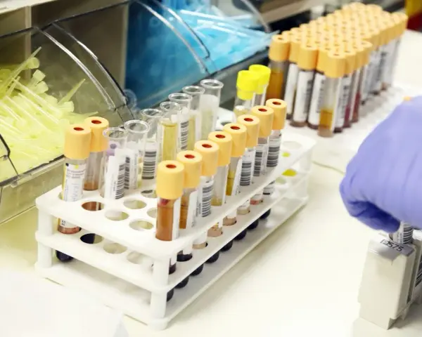 Probówki z próbkami krwi w laboratorium, ręka w rękawiczce pobiera jedną z nich.
