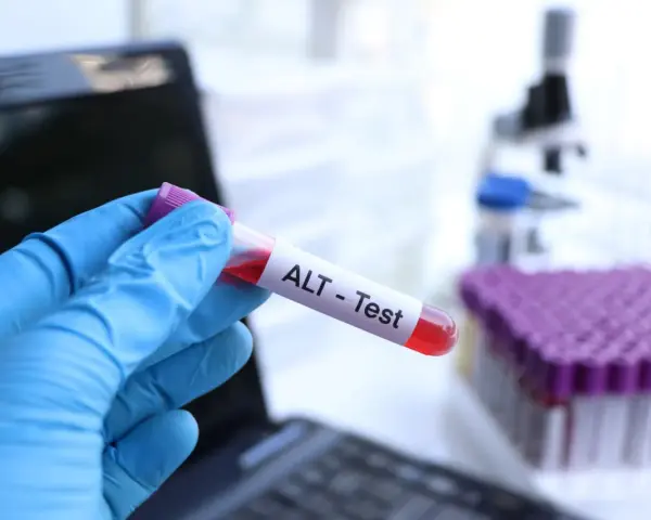 Ręka w niebieskiej rękawiczce trzyma probówkę z krwią oznaczoną "ALT - Test". W tle mikroskop i stojak z probówkami.