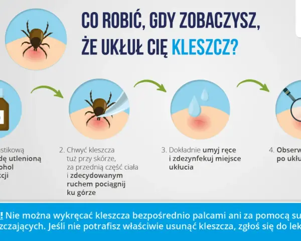 Instrukcja, jak wyciągnąć kleszcza: przygotuj pęsetę i środek dezynfekujący, chwyć kleszcza blisko skóry i pociągnij, umyj ręce i miejsce ukłucia, obserwuj.