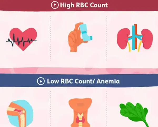 Grafika przedstawia ikony serca z EKG, inhalatora, nerek (wysoki poziom erytrocytów) oraz stawu kolanowego, tarczycy i liścia szpinaku (niski poziom erytrocytów/anemia).