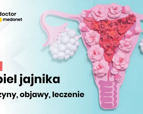 Jakie leki na torbiel jajnika? Skuteczne opcje leczenia i objawy