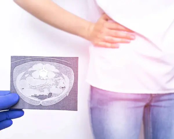 Lekarz pokazuje tomografię jamy brzusznej, sugerującą nieostre zapalenie wyrostka objawy. Pacjentka trzyma się za brzuch.
