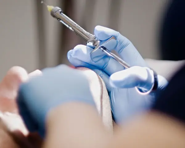 Czy na pogotowiu dentystycznym wyrywają zęby w nagłych przypadkach?
