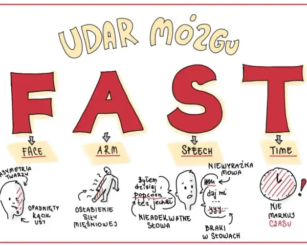 Ilustracja przedstawia akronim FAST (Face, Arm, Speech, Time) opisujący objawy udaru mózgu.