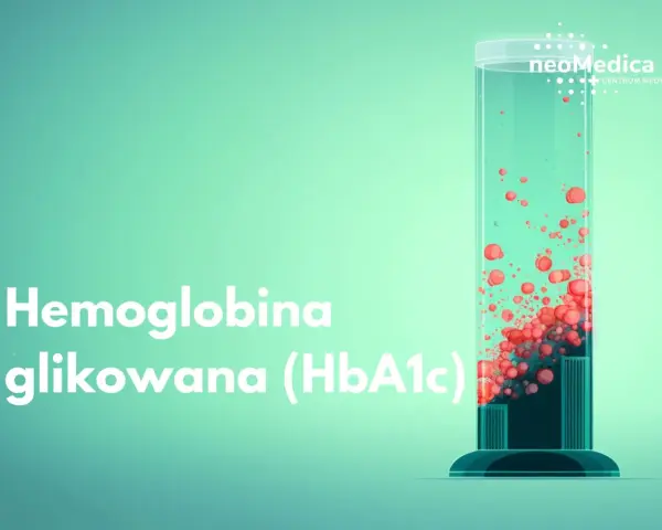 Szklana probówka z czerwonymi kropelkami i napisem "Hemoglobina glikowana (HbA1c)".